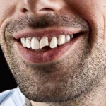 Lakewood Dental Centre
